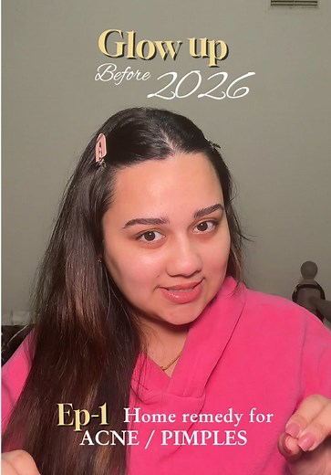 Glow Up Before 2026: Easy Home Remedy for Acne