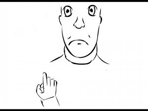 Moebius Syndrome/Mobius Syndrome