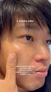 54K views · 356 reactions | Husband’s road to glass skin with Infini. Janice Lestones Tsuji No filter. My husband always struggled with breakouts and irritation from shaving. After using the Infini products, his skin looks clearer, smoother, and more hydrated. So happy with the difference! Sabe pa niya sakin kagabi “Mahal? Paubos na ang serum”.  #INFINISERUM | Japan Life Updates | Facebook