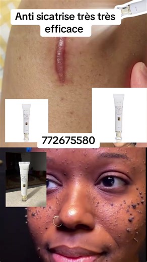 75 554 04 55 sur TikTok