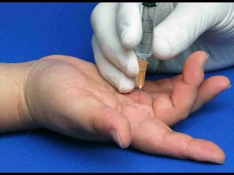 Hand Injection Techniques - General Principles