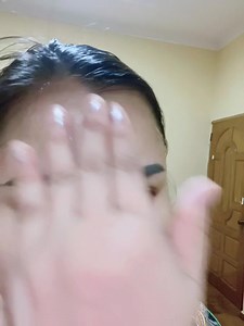 Skincare MD Skincare Myanmar | MD Skincare Myanmar