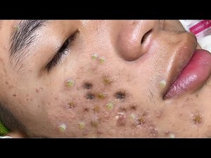 Satisfying videos for Relaxation with XINH SPA CHANNEL 5#63