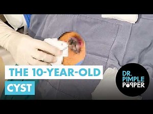 10 Years In the Making!