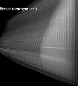 With 3D mammograms, also called breast tomosynthesis, our specialists at Wayne UNC can detect breast cancer earlier and reduce the number of false positives. Learn more and schedule your 3D mammogram by visiting wayneunc.org/wellness/health-talk-blog/health-talk/2019/the-benefits-of-3d-mammograms. | UNC Health Wayne