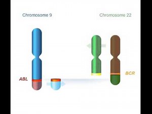 Chromosomes Philadelphie + bcr abl