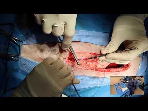 Abdominal exploration in a dog with h a possible obstruction