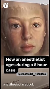 How Anesthesia ages during protracted surgery.. #anesthesialife #anesthesiaresident #anesthesiologist #crnaschool #crna #anesthesiatech #surgeon | Anesthesia