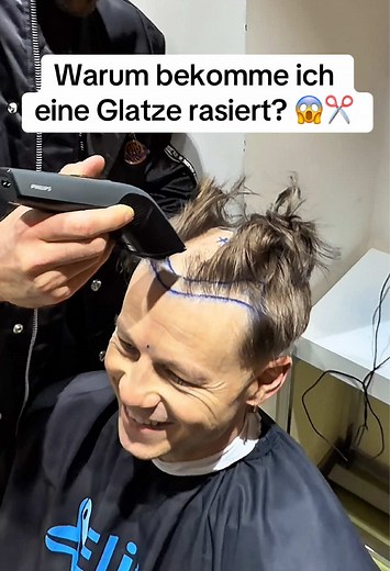 Eigen-Haar OP in Istanbul: Glatze oder nicht?