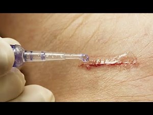 Cuts: the right actions to take - The Health Magazine