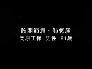 股関節痛・肺気腫の患者様の声