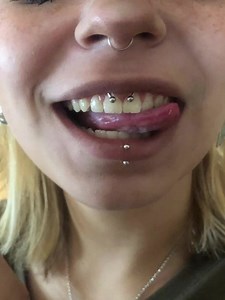 Smiley Piercing Ideas: Smiley Piercing Inspiration and Aftercare
