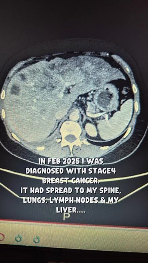 Grateful for Health: Holistic Cancer Healing Journey