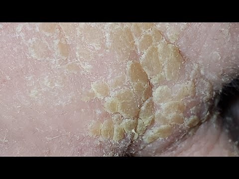 Skin Strips and Cheese