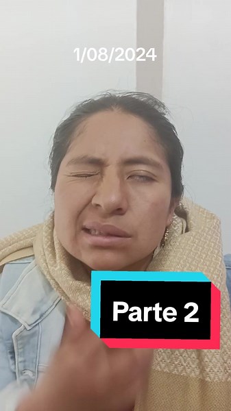 Proceso de la Parálisis Facial: Resultado Final Pronto