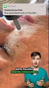 1.4M views · 6.8K reactions | Adio riduri și cicatrici cu acest laser  YT: madalin.doctor.to.be1 #studentlamedicina #doctor #medic #curiozitati #curiozitatimedicale #informatii #laserCO2 #LaserCO2fractional #PielePerfectă | Doctor Madalin | Facebook
