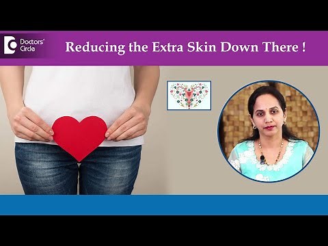Clitoral Hood Reduction |Extra skin down there and intimacy issues?-Dr.Sangeetha M J|Doctors' Circle