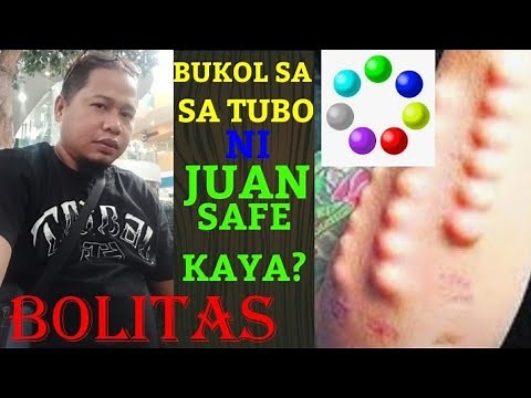 BOLITAS SA TUBO NI JUAN Yummy Ba?