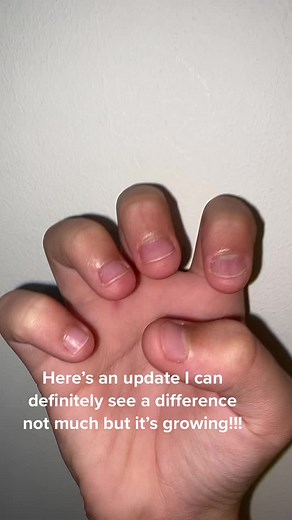 #nails#growth #grownailsfaster