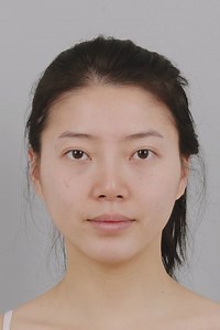 58 reactions | Joen mi hua(Korea) Name of surgery: Two jaw, V-line, Cheek bone Reduction, Eyelid, Rhinoplasty, Fat face | Korea Plastic Surgery | Facebook