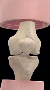 19K views · 159 reactions | Loose bodies in the knee may initially be...