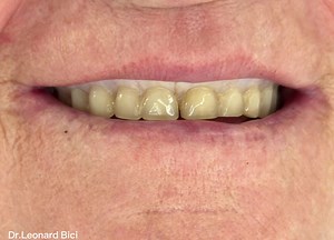 Dental Home on Reels | Facebook