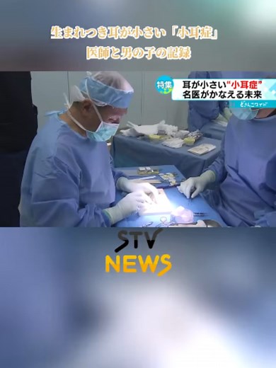 【名医が執刀】生まれつき耳が小さい「小耳症」 新しい耳ができた！医師と男の子の記録 #小耳症 #手術 #マスク #耳 #名医 #北海道 #ＳＴＶ #TikTokでニュース