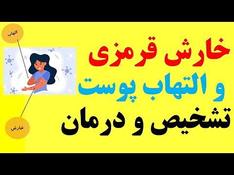 Skin rashes that itch چگونه انواع خارش قرمزی و التهاب پوست را تشخیص و درمان کنیم