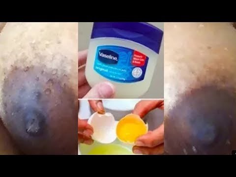 How to tighten sagging breast naturally and fast with Vaseline