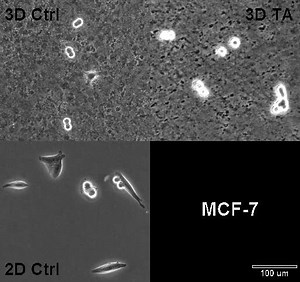 File:Staged-stromal-extracellular-3D-matrices-differentially-regulate-breast-cancer-cell-responses-1471-2407-9-94-S2.ogv - Wikimedia Commons