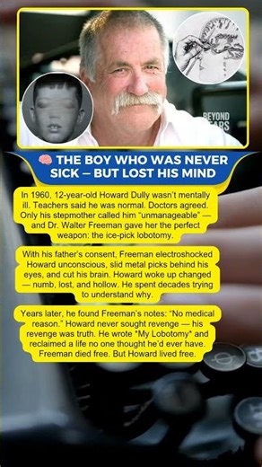 The Boy Who Survived His Own Lobotomy