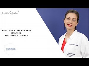 🔴TRAITEMENT DE VERRUES AU LASER: MÉTHODE RADICALE