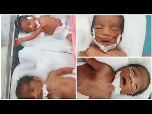 Preterm triplet baby|Day 4 in NICUActivity & vitals: NORMAL 💙#NICU #Preemie #Triplets #NewbornShorts