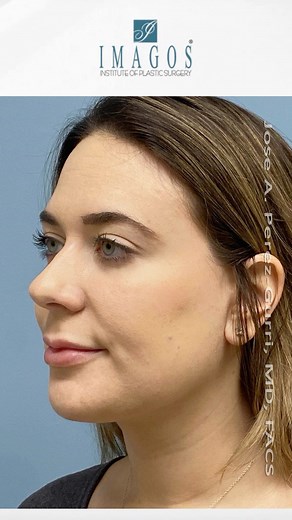 Imagos Plastic Surgery on Reels | Facebook