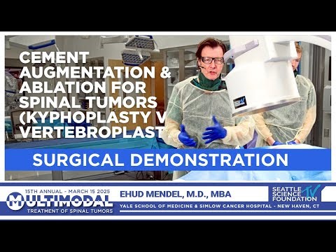 Cement Augmentation and Ablation for Spinal Tumors Kyphoplasty vs Vertebroplasty - Ehud Mendel, MD