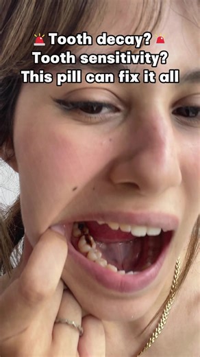 beautifulteeth_us on TikTok