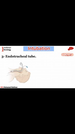 🧧ما الفرق بين Endotracheal tube ,Nasotracheal tube , tracheostomy ⁉️ ▪️جزء من فيديو التنبيب الرغامي Endotracheal intubation ▪️هتلاقي لينك الفيديو كامل أول كومنت ❤️🔥 #ETT #Heart #ECG #LUNG #doctor #medicine #nursing #nurse #vent #intubation | Nursology - نيرسولوجى