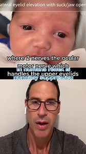 Very peculiar sign when feeding. Watch the eyes️ #doctorsof #nursesof #neurology #neonatologia #nicu #pregnancy | Scene Stash