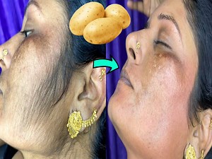 1.4K views | DIY Hair Removal Cream| Unwanted Facial Hair Removal | Simple Home Remedies | Facebook