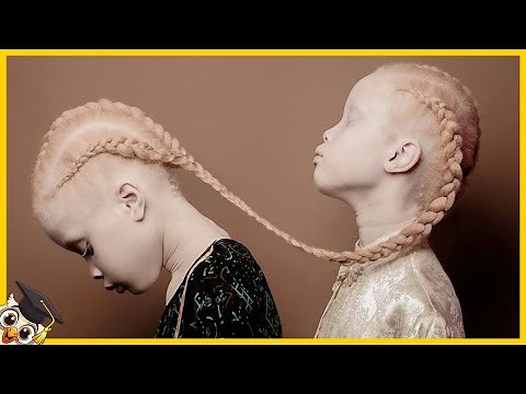10 children who are born only once in a thousand years