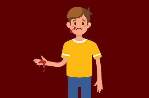 Jangan Panik, Ini Penyebab Mimisan pada Anak