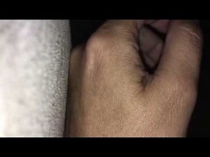 Hand twitching moves finger