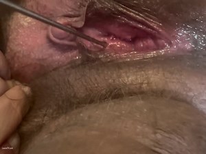 FTM Pee Hole Sounding