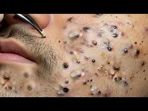 𝑺𝒐𝒐𝒕𝒉𝒊𝒏𝒈 𝑭𝒂𝒄𝒊𝒂𝒍 𝑻𝒓𝒆𝒂𝒕𝒎𝒆𝒏𝒕 𝑭𝒐𝒓 𝑺𝒕𝒓𝒆𝒔𝒔 𝑹𝒆𝒍𝒊𝒆𝒇 𝒂𝒕 𝑳𝒖𝒙𝒖𝒓𝒚 𝑺𝒑𝒂 𝑨𝒄𝒉𝒊𝒆𝒗𝒆 𝑰𝒏𝒏𝒆𝒓 𝑷𝒆𝒂𝒄𝒆 #263265