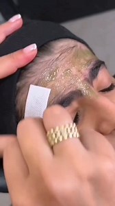 40K views · 39 reactions | Remove Facial Hair At Home Easily | Permanently Upper Lips & Facial Hair Removal Pack . . . #facial #facialhairremoval #hairremoval #hair #hairremovalpack #upperlips #upperlipsremoval #skincare #treandingreels #reelsfacebook #fypviralシ #viralreelsシ #explorepage | Natural Beauty Remedy | Facebook