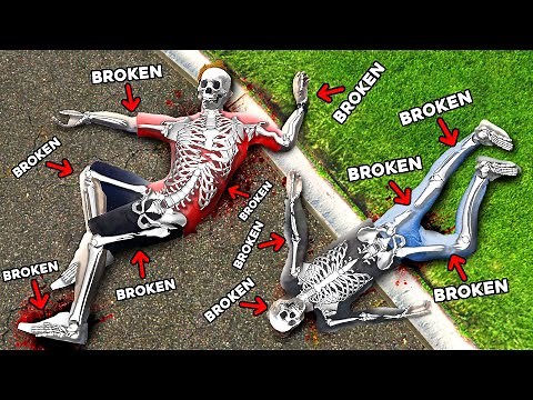 We Broke EVERY BONE in GTA 5 RP.. (Mods)