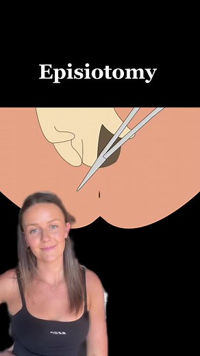 Understanding Episiotomy: Procedure, Indications, and Experience