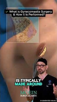 What is Gynecomastia & How is it Treated? 💪✨ #drmoein #babakmoein #gynecomastia