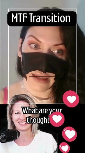 MTF Life Before & After Genital Correction Surgery