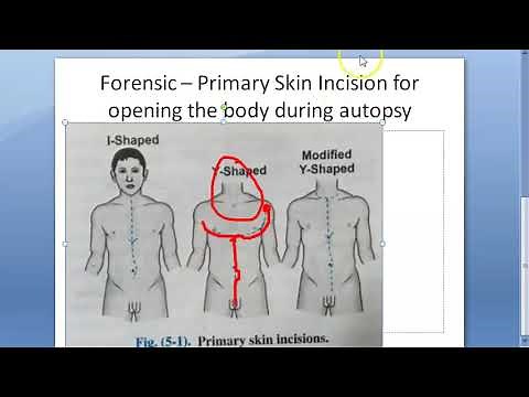 Forensic 050 a I shape Incision Y modified technique Autopsy Medico Legal Postmortem